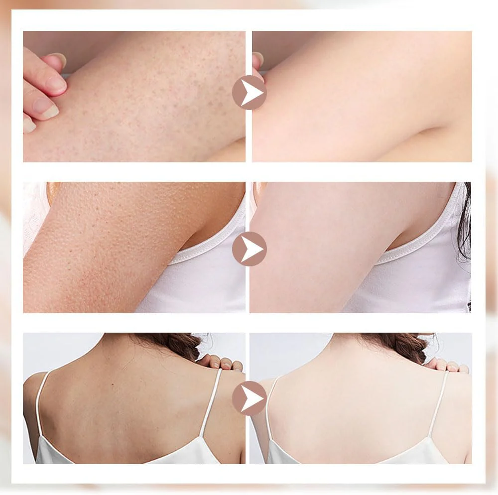 Super Soft Sunflower Suction Cup Bath Ball, 2024 Upgraded 2-in-1 Sunflower Bath Ball Exfoliating Bath Sponge Cleaning Brush, Sponge Mesh Pouf Shower Ball for Women, Men Shower